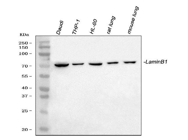 Western Blot analysis of Lamin B1